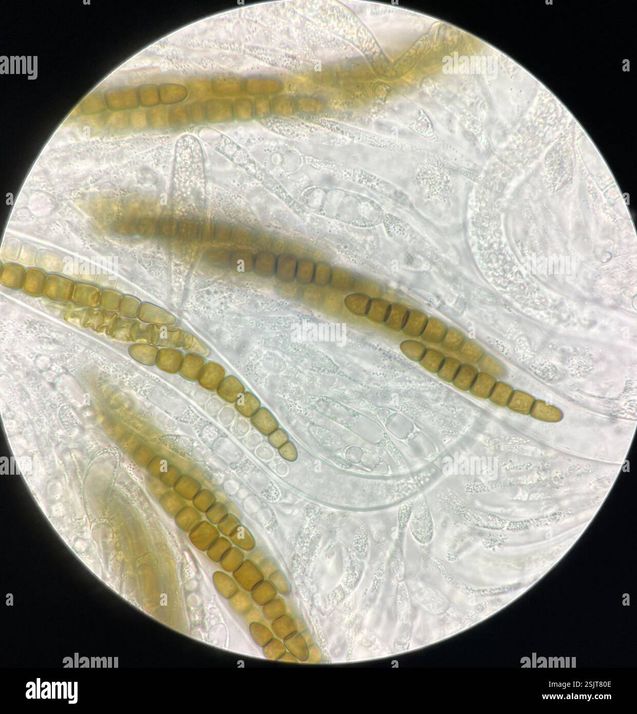 (Sporormiella tela), funghi, Bronx, NY, Stati Uniti, spore 73-86μm x und 8,5-11,5μm. Corpi fruttiferi multipli estremamente tomentosi coperti da una trama miceliale nera Pseudothecia fino a 0,6 mm di larghezza. 7-11 cellule cellulari, 8 cellule più comuni, seguite da 9 e 10 cellule, 11 e 7 cellule rare che crescono su sterco di branta canadensis menzionato da Richardson dall'Islanda; nuovo clade non descritto, potenzialmente in Preussia piuttosto che Sporormiella corrisponde a un campione di terreno proveniente dall'altopiano tibetano con 3bp di differenza (4600m di altitudine) e due campioni di suolo estoni per albero filogenetico vedere l'ultima immagine sequenza LSU OR226402 olotipo per Foto Stock