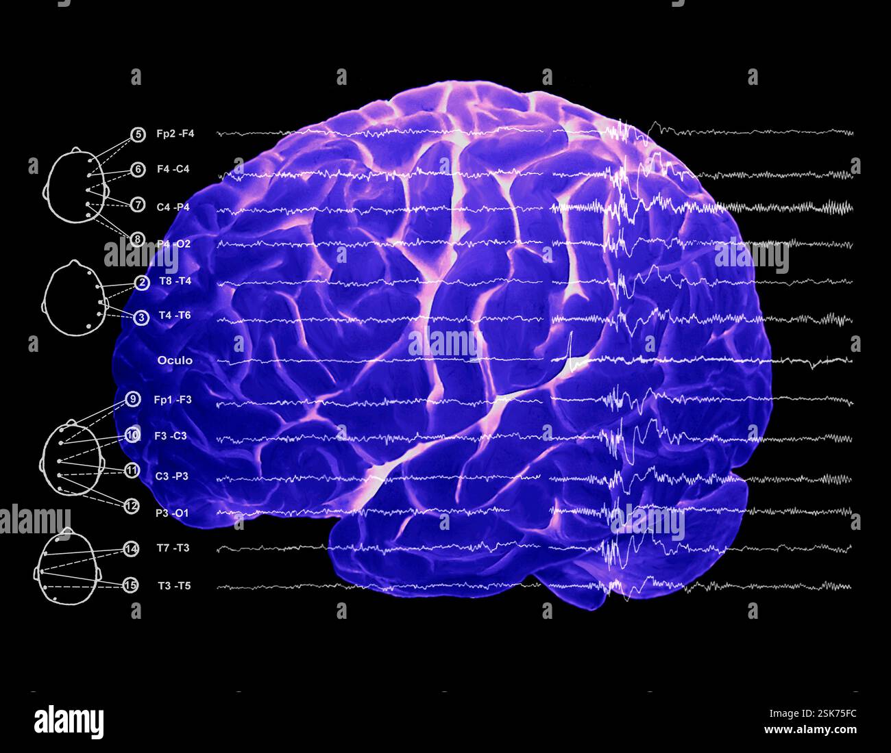 Cervello e onde cerebrali durante il sonno Foto Stock