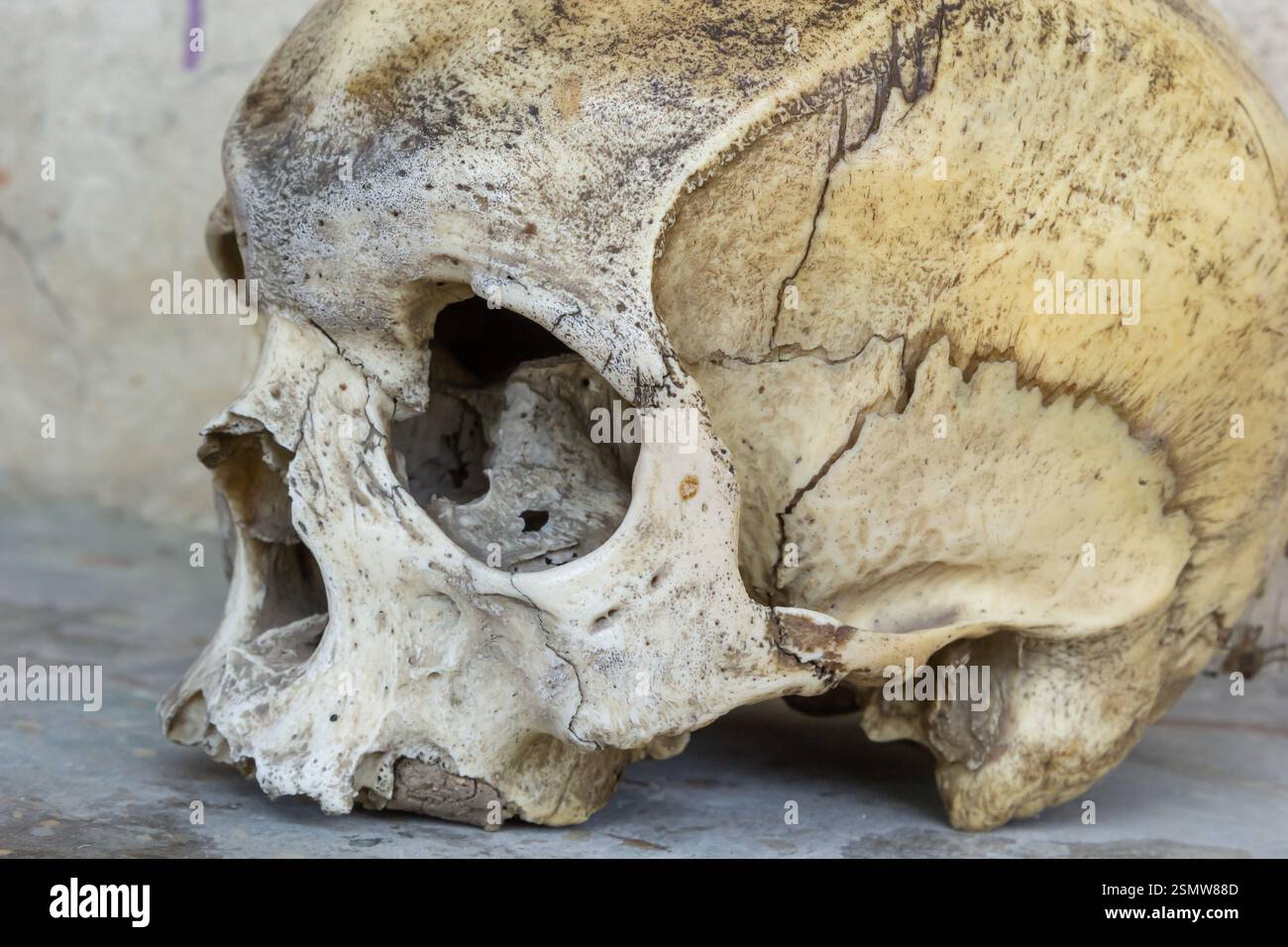 Un artefatto cranico poggia su una superficie, mostrando crepe notevoli e caratteristiche obsolete. La consistenza e la colorazione rivelano il suo significato storico e ag Foto Stock