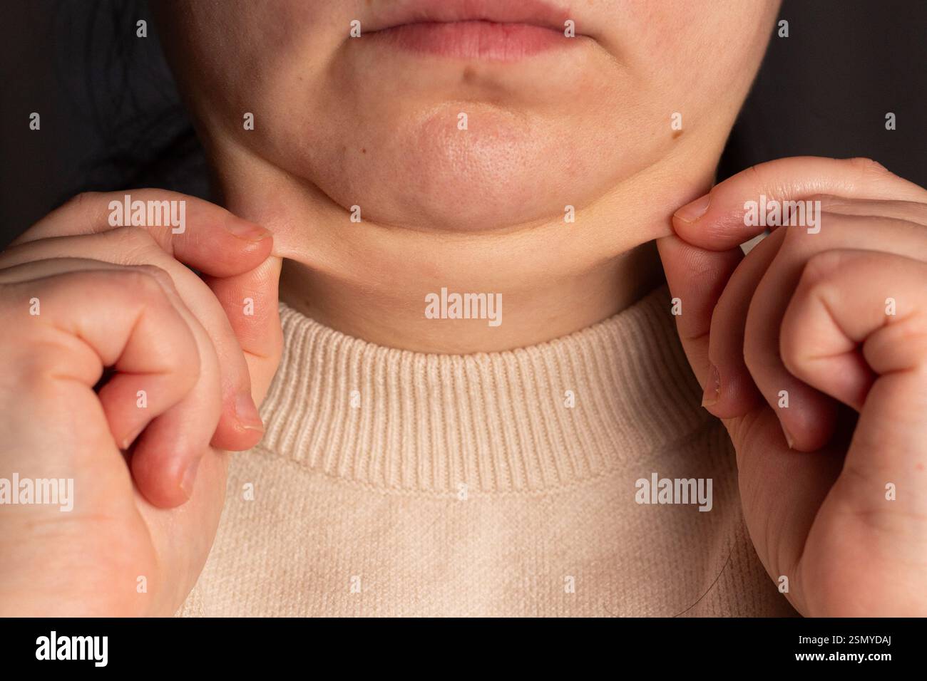 Immagine ravvicinata del secondo mento femminile. Donna in sovrappeso che dimostra il secondo mento. Problema di eccesso di peso. Concetto di chirurgia di correzione del doppio mento. Foto Stock
