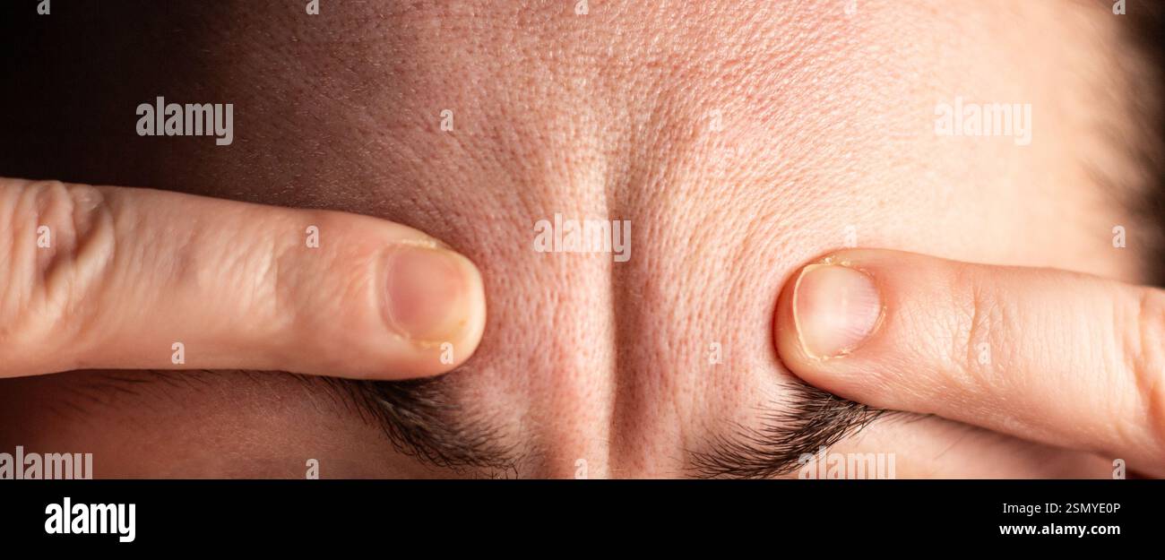 Donna che mostra rughe sulla fronte. Concetto di età. Pelle naturale con rughe. Immagine per gli argomenti relativi a cosmetologo e iniezioni facciali. Foto Stock
