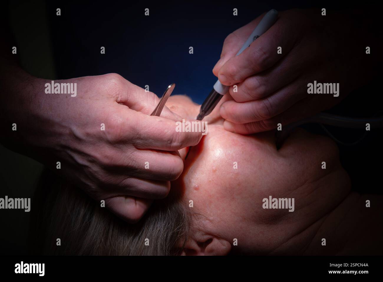 Signor Nigel Carver, chirurgo cosmetico che lavora nel teatro Foto Stock