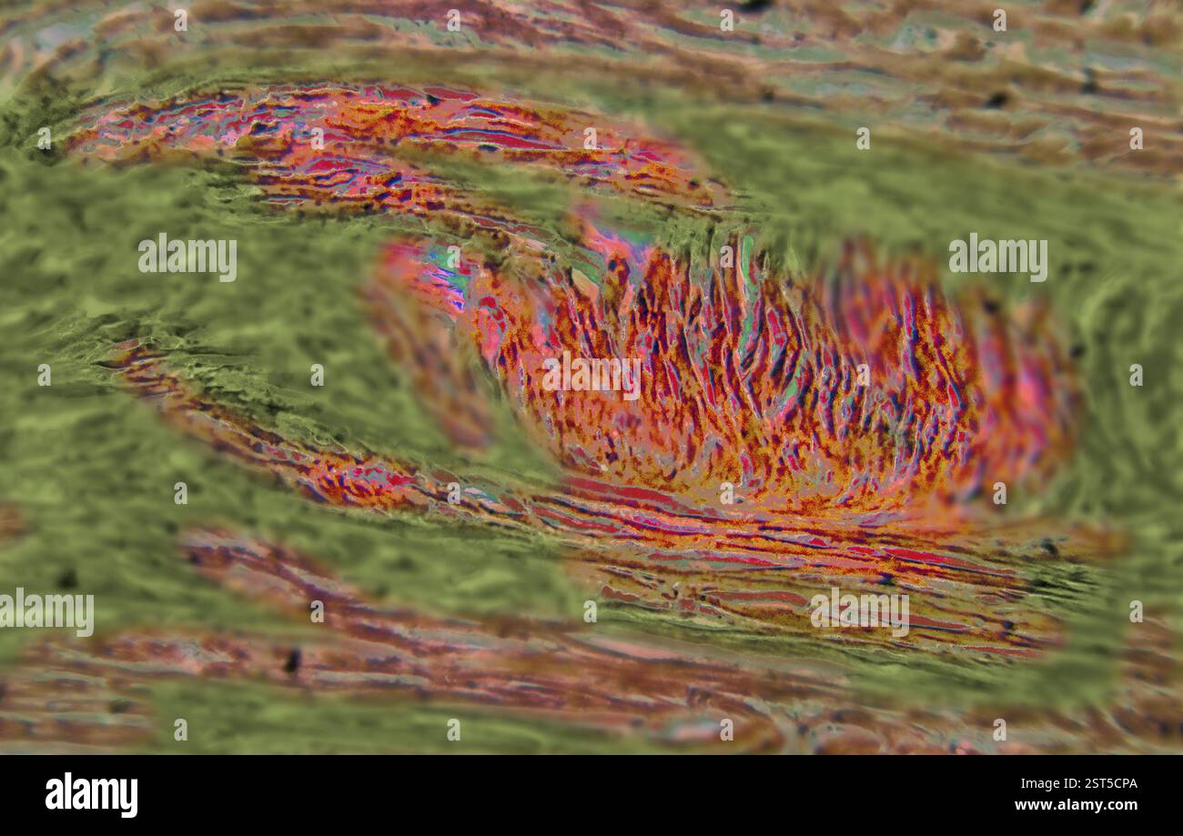 Fireheart, arte pittorica della sezione trasversale del muscolo cardiaco, è stata microfotografata e ha ricevuto un trattamento digitale per mostrare il fuoco delle emozioni in t Foto Stock