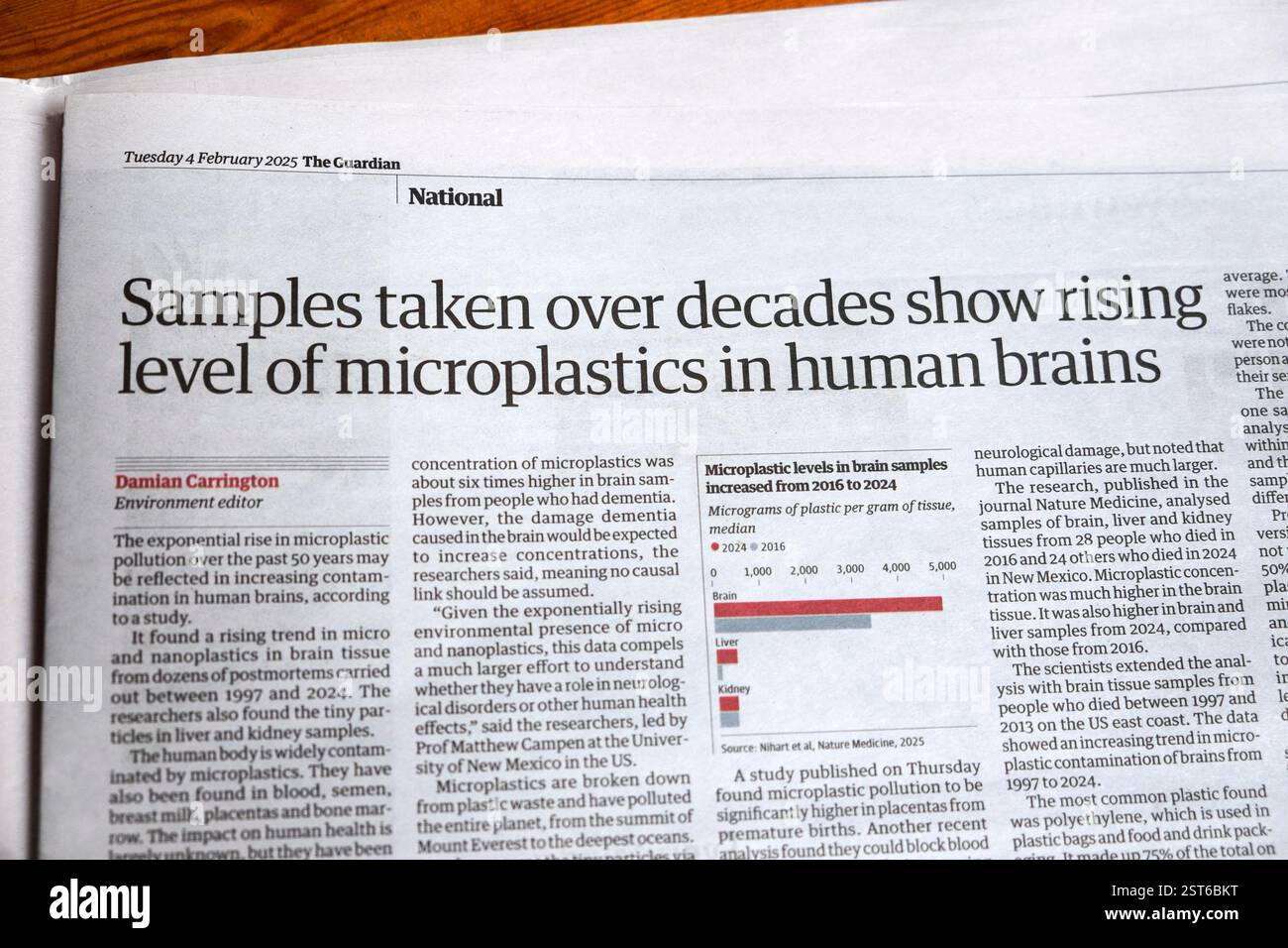 "I campioni prelevati nel corso di decenni mostrano un aumento del livello di microplastica nel cervello umano" Guardian testata impatto salute articolo 4 febbraio 2025 Regno Unito Foto Stock