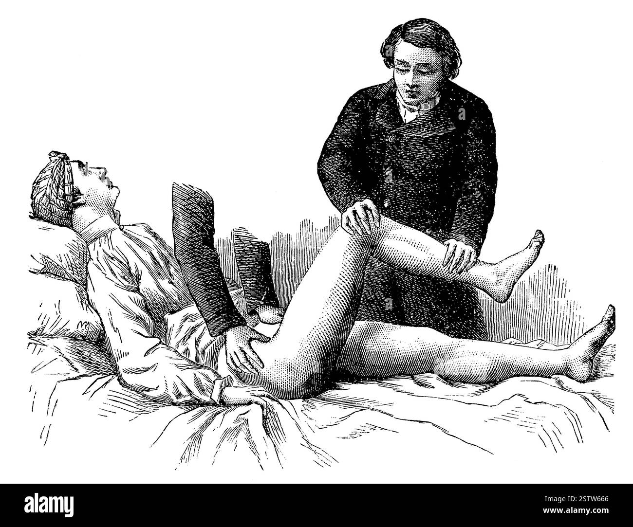 Adeguamento della coscia dislocata secondo il metodo odierno (1893). Illustrazione del XIX secolo Foto Stock