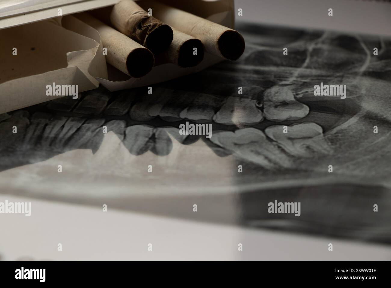 Sigarette giacciono su una radiografia dentale panoramica, carie di nicotina, denti cattivi fumatori Foto Stock