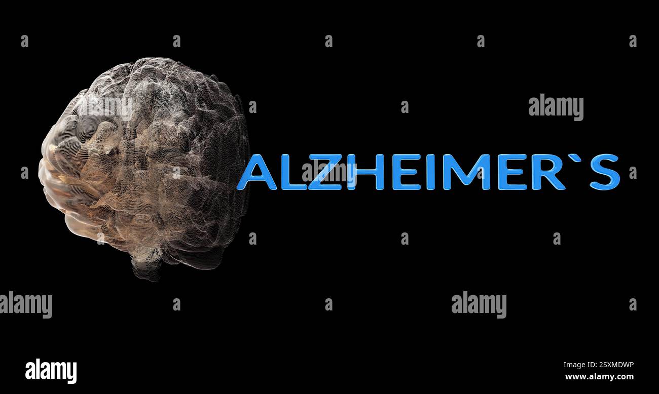 Deterioramento del modello cerebrale con il testo "ALZHEIMER", raffigurante la condizione neurodegenerativa e la perdita di memoria. Foto Stock