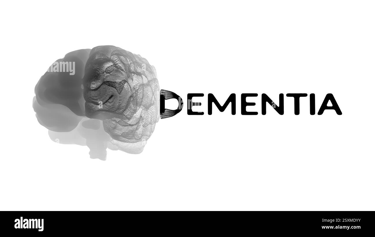Visualizzazione della scansione cerebrale collegata al testo "DEMENZA", che illustra il declino cognitivo e la degenerazione neurale associata alla malattia. Foto Stock