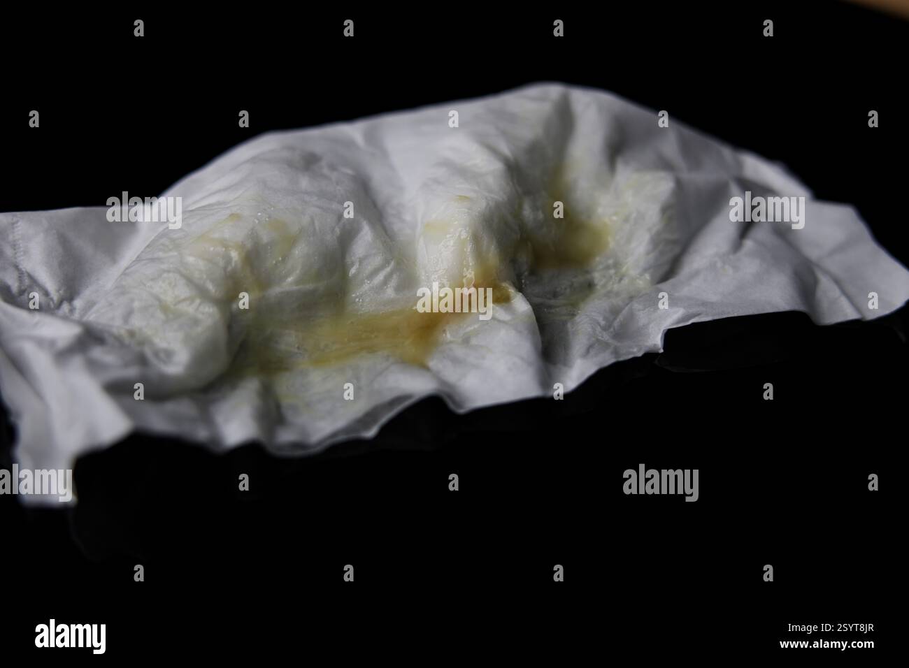 Infezione toracica flemmia e sangue da vicino. Foto Stock