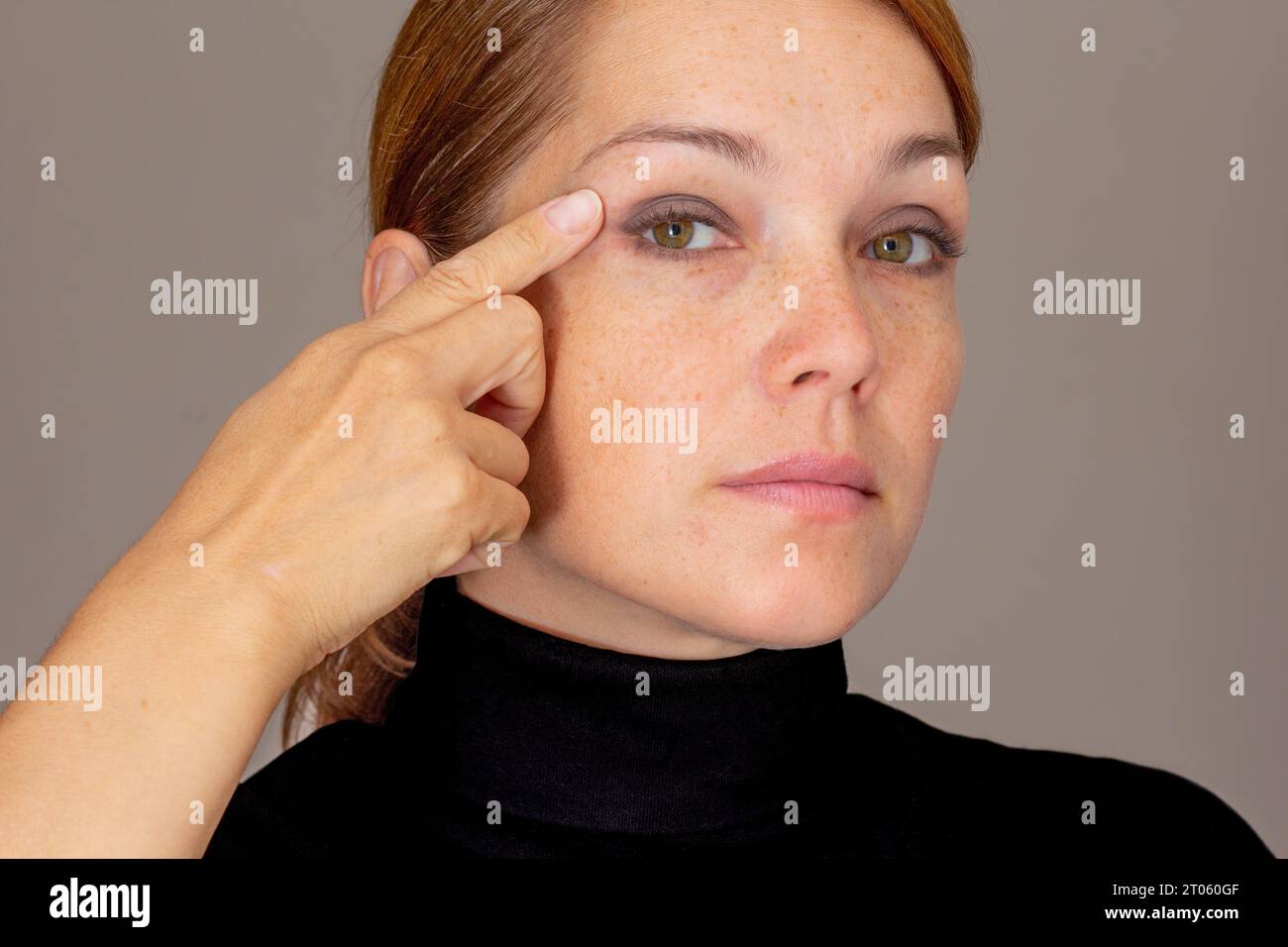 Ritratto di una donna con le lentiggini che appare sulla palpebra con le dita Foto Stock