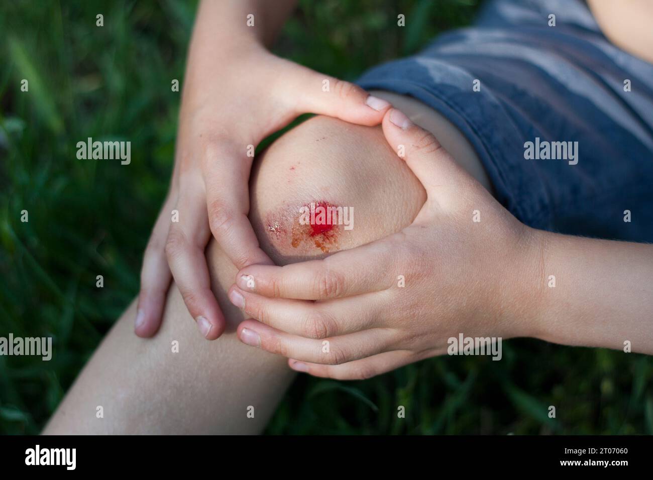 Primo piano della ferita sanguinante fresca sul ginocchio del bambino a causa della caduta. Trauma infantile, dolore, disattenzione, incidente. Estate, all'aperto Foto Stock