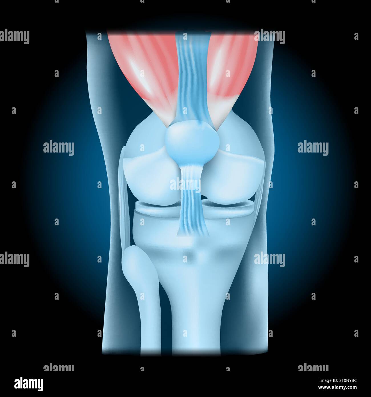 Articolazione del ginocchio con quadricipite. Vista frontale del ginocchio umano con effetto luminoso. Giunto blu trasparente realistico su sfondo scuro. illustrazione vettoriale lik Illustrazione Vettoriale