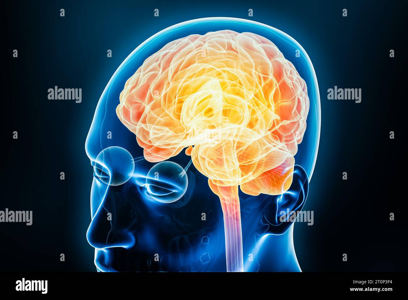 Attività neurale del cervello umano o infiammazione rappresentazione 3D a raggi X con il corpo. Anatomia, malattia neurologica, cefalea, intelligenza, medico, Foto Stock