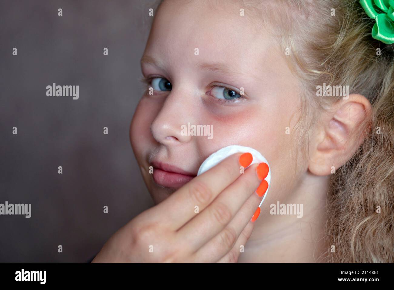 problemi di igiene, pelle pulita e fresca. La madre salvietta la pelle del viso alla ragazza a Cotton Disk. Il concetto di cura della pelle nei bambini, ragazze. Cura del viso. la mano Foto Stock