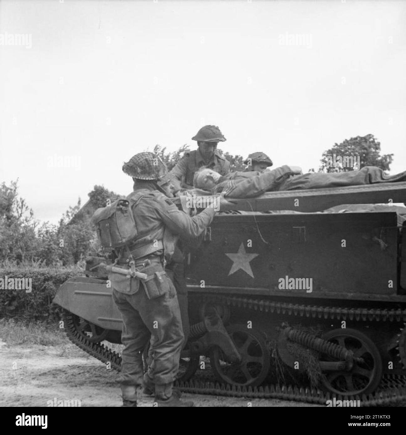 L'esercito britannico in Normandia 1944 un infortunato su di una barella essendo collocato su un supporto universale prima di essere prelevati ad un aiuto del reggimento post, vicino Lingevres, 16 giugno 1944. Foto Stock