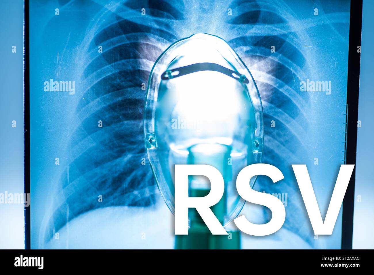 Sfondo di virus respiratorio sinciziale (RSV) e radiografia toracica, concetto medico Foto Stock
