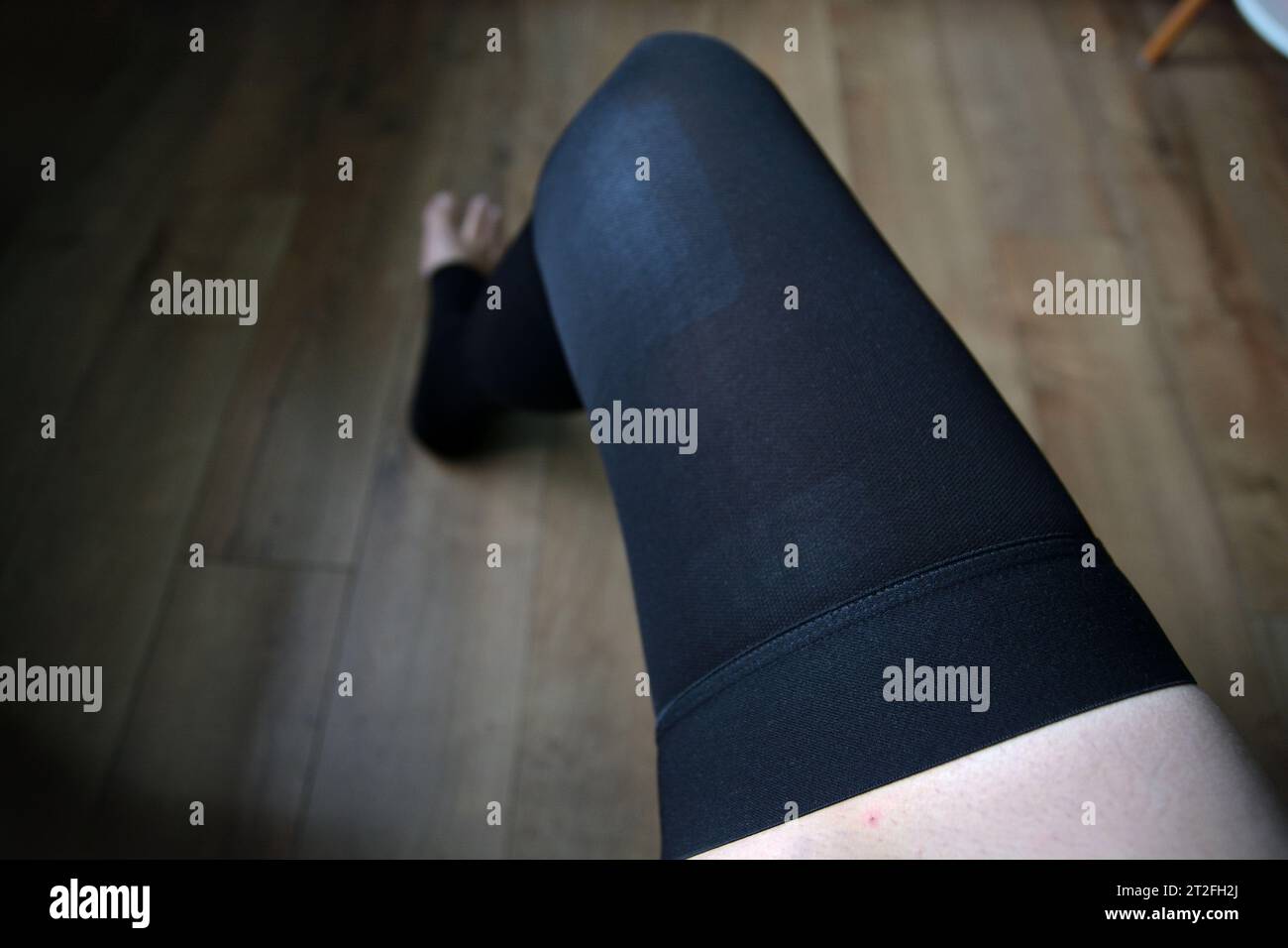 Una vista delle calze unisex elastiche della coscia a compressione medica senza vestizione puntale sulla gamba della persona dopo un intervento chirurgico alla vena varicosa con un laser. Foto Stock