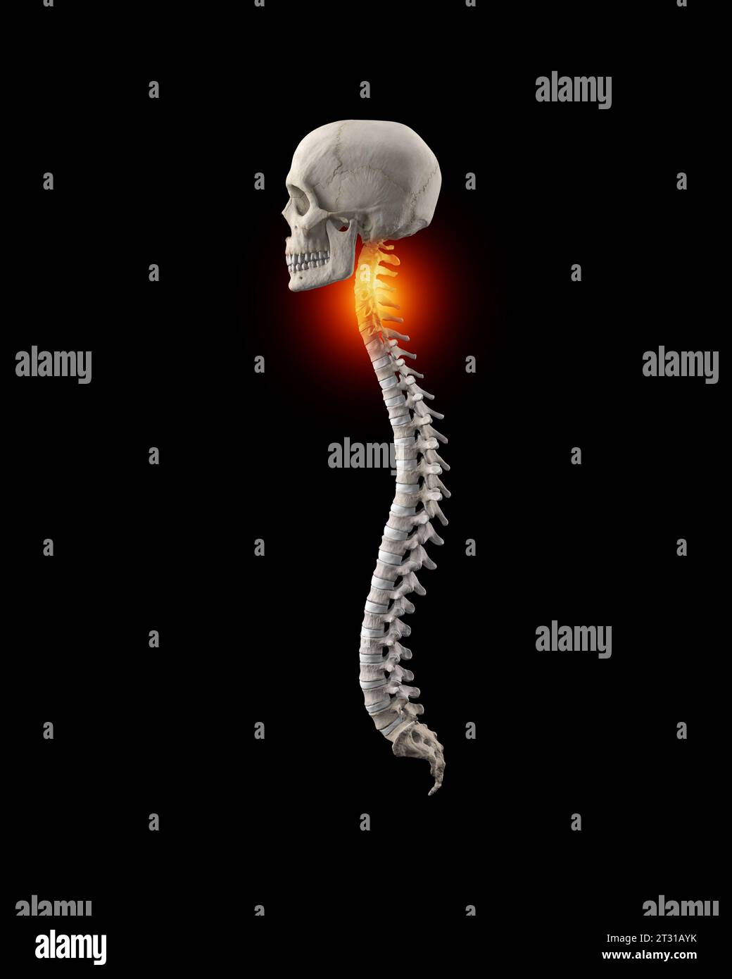 Colonna vertebrale umana con dolore lombare nella regione cervicale Foto Stock