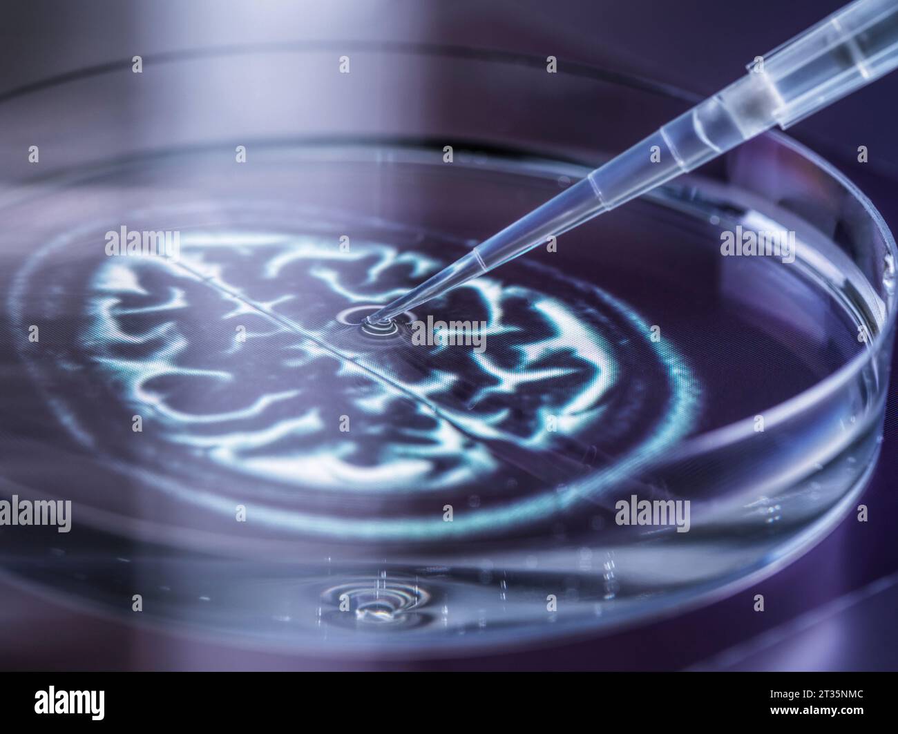 Pipettaggio di campioni di DNA dalla capsula di Petri Foto Stock