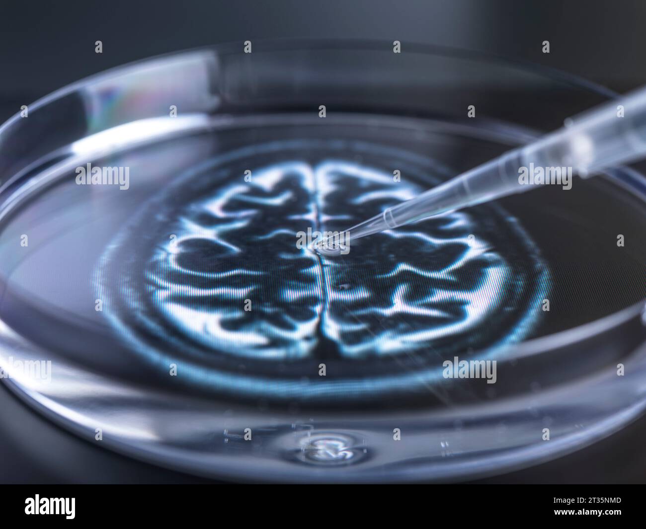 Il pipettaggio di campione nella vaschetta per il test del DNA Foto Stock