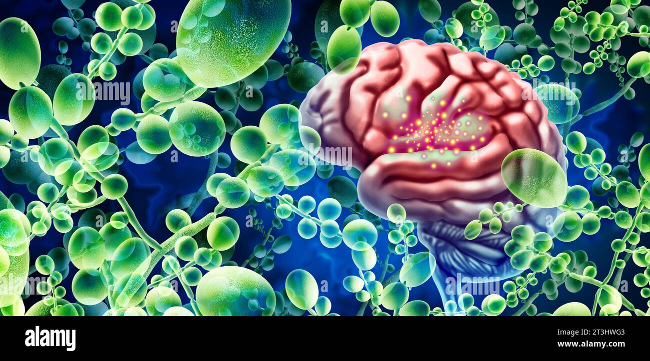 Demenza del fungo cerebrale come infezione fungina o contaminazione di funghi correlati all'Alzheimer o perdita di memoria e malattia di funzione neurologica. Foto Stock