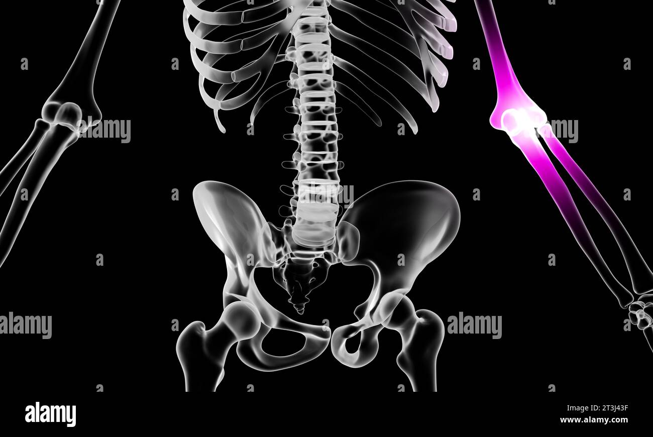 illustrazione in 3d di un'anatomia umana con dolore al gomito Foto Stock