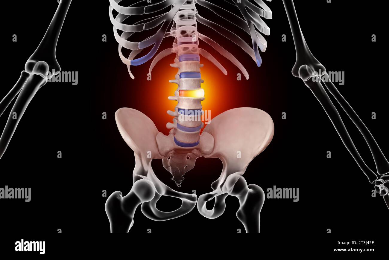 Anatomia della colonna vertebrale umana. Mal di schiena e mal di schiena Foto Stock