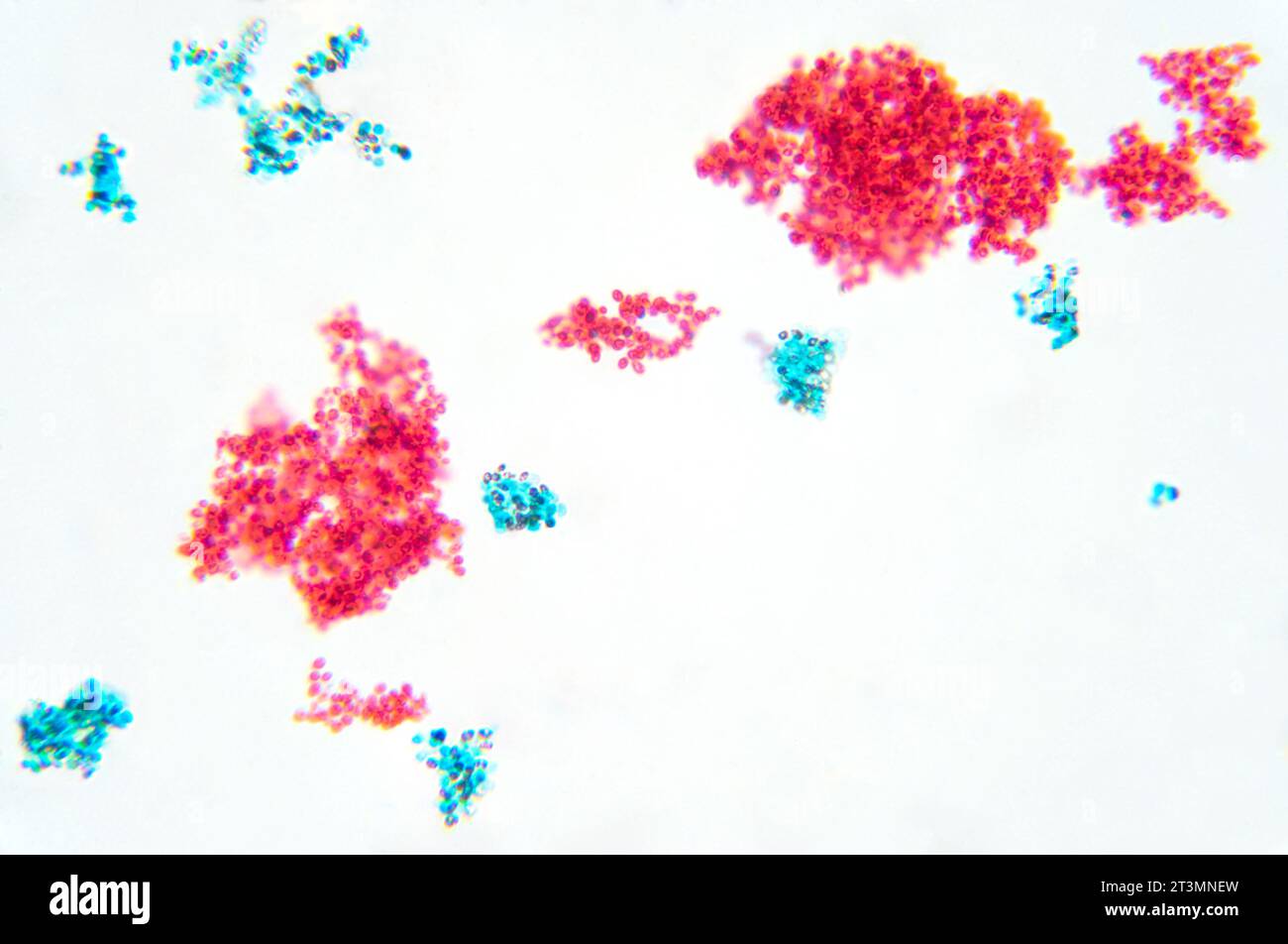 Cellule di lievito, supporto intero, micrografo leggero 80X. Striscio di Saccharomyces cerevisiae, lieviti da birra o da forno, eucariotici, microrganismi monocellari. Foto Stock