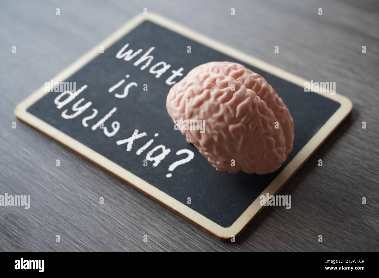 Concetto medico e sanitario. Immagine di primo piano del modello cerebrale umano e lavagna con testo COS'È LA DISLESSIA? Foto Stock