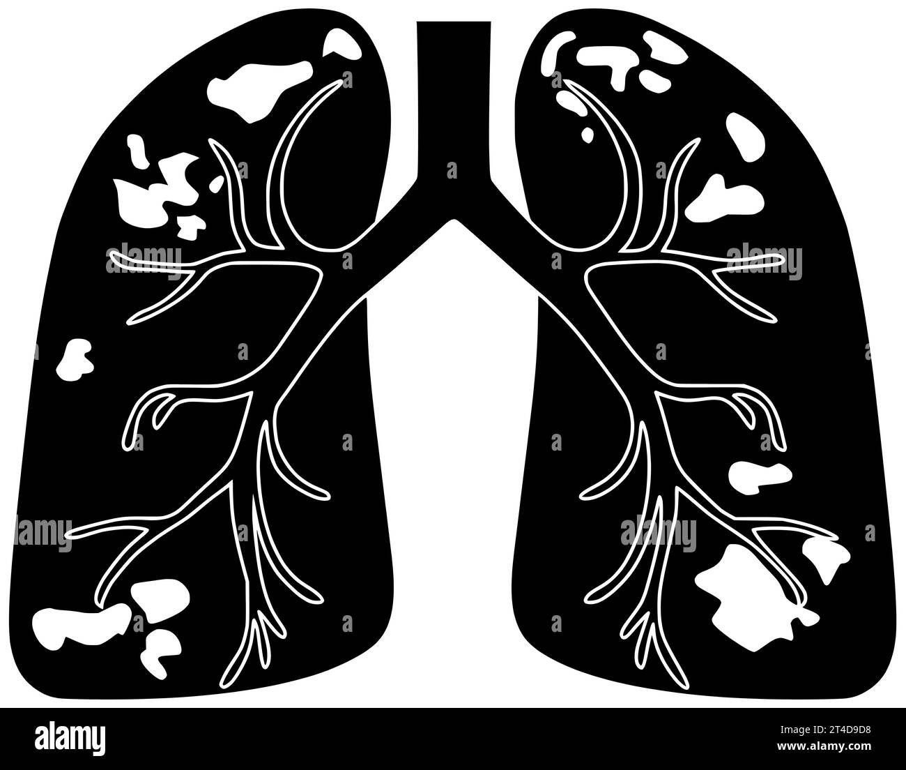 malattia polmonite nera silhouette illustrazione respiratoria icona polmonare logo del virus asma polmonare cura malattia cancro infezione bpco bronchite tubercolosi medica Foto Stock malattia polmonite nera silhouette illustrazione respiratoria icona polmonare logo del virus asma polmonare cura malattia cancro infezione bpco bronchite tubercolosi medica Foto Stock