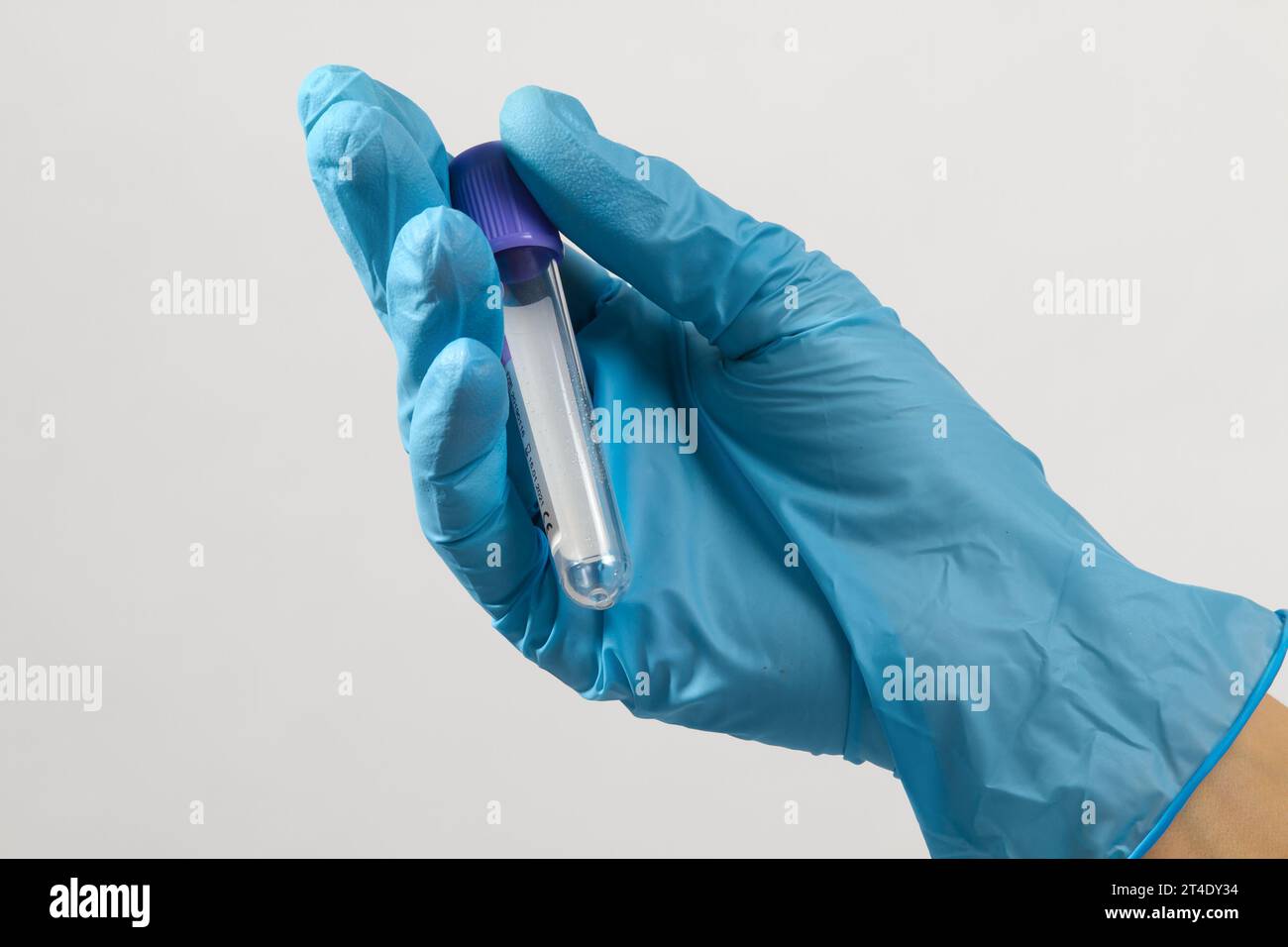 la mano di un operatore medico in un guanto sterile contiene una provetta per l'analisi del sangue pulita Foto Stock