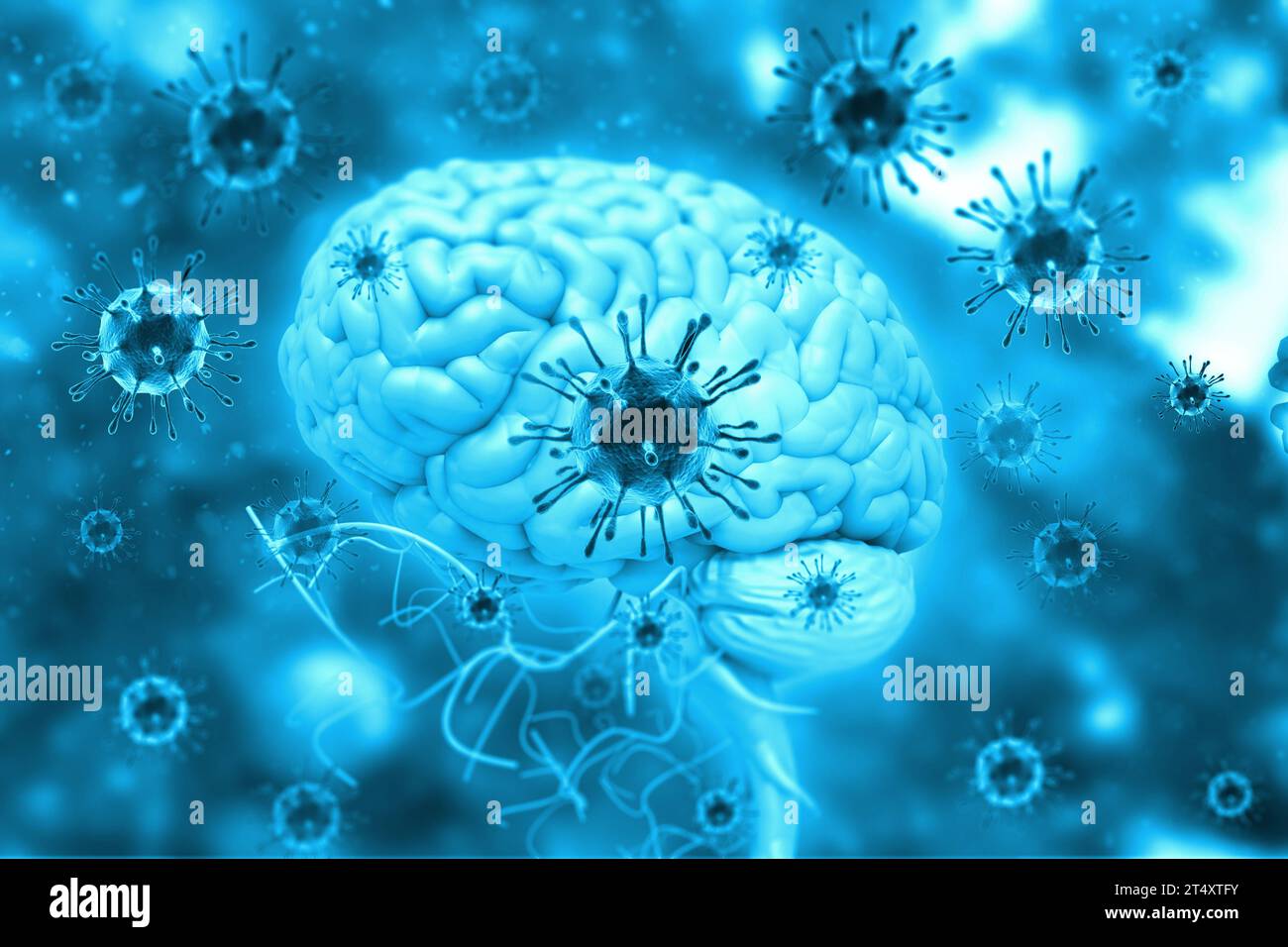 Infezione da virus sul cervello. illustrazione 3d. Foto Stock