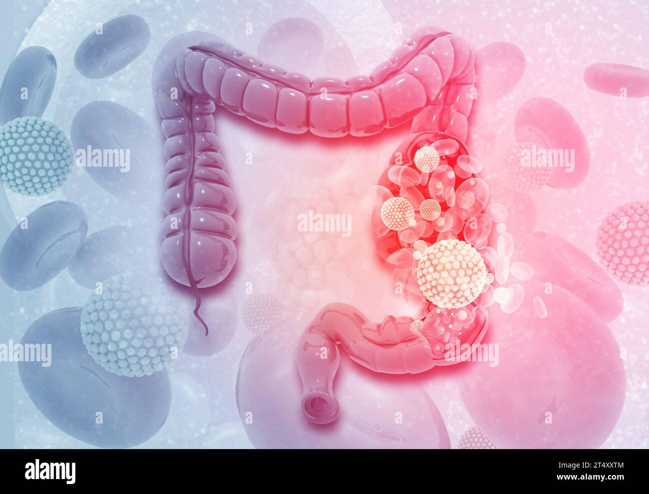 Cancro al colon. Cellule virali sul colon. illustrazione 3d. Foto Stock