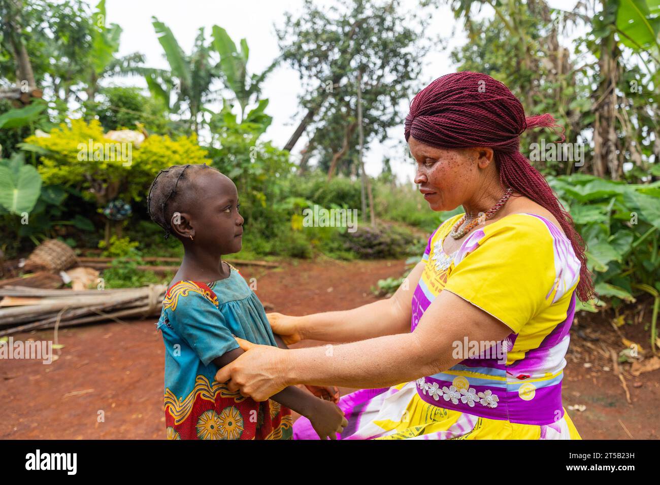 La giovane madre albina africana sta avendo una conversazione con la sua bambina e la sta educando. Foto Stock