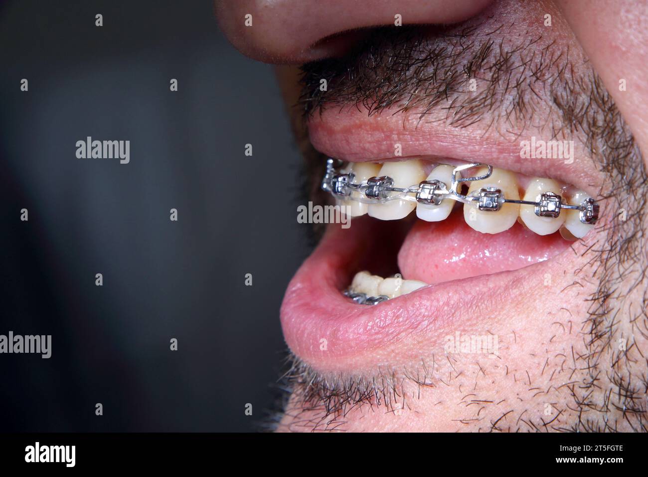 Studio dentistico. Il posto di lavoro del dentista. Giovane donna in visita dal dentista alla clinica. Dentista maschile con paziente in clinica. Foto Stock