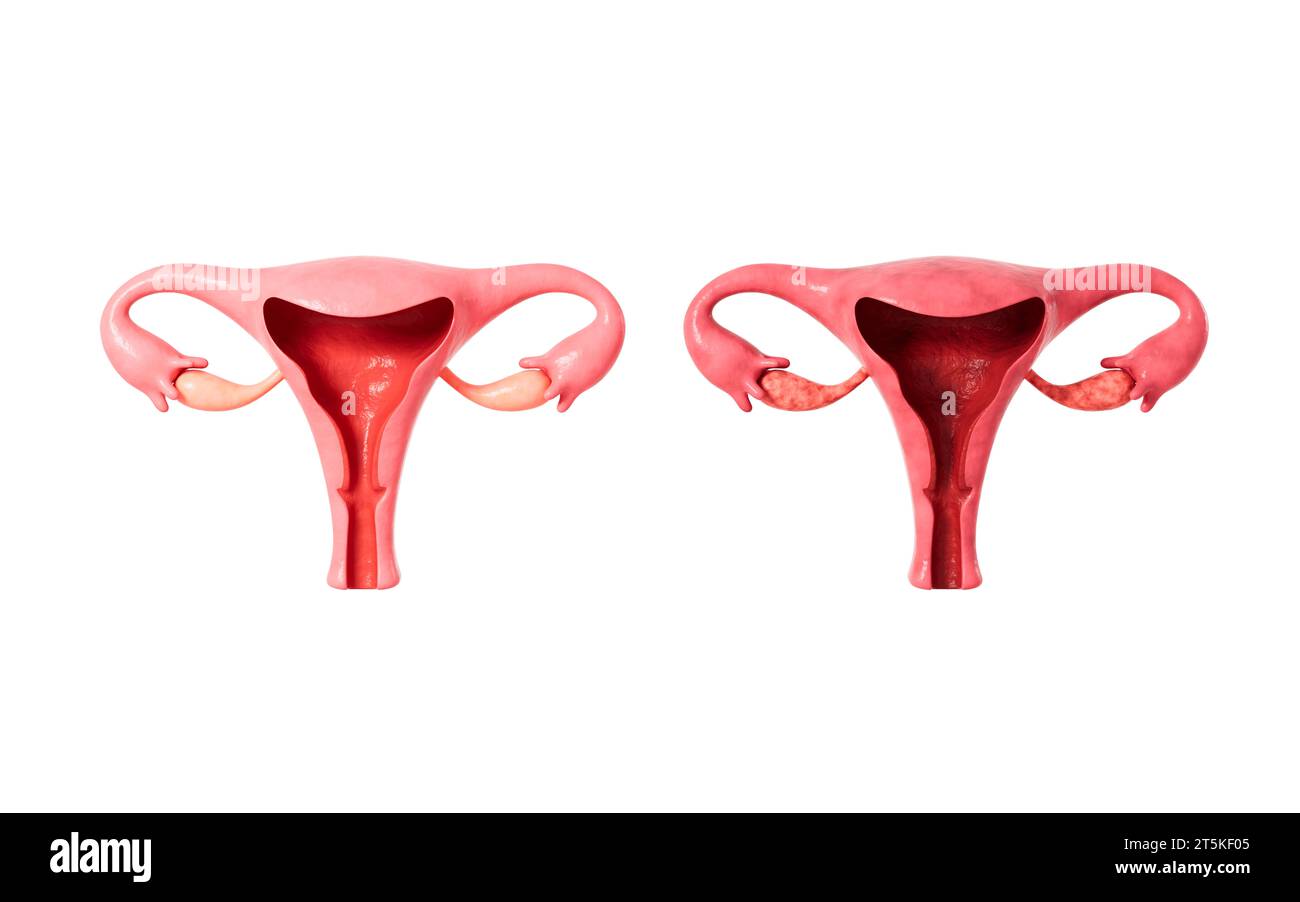 Modello di utero umano, rendering 3D. illustrazione 3d. Foto Stock