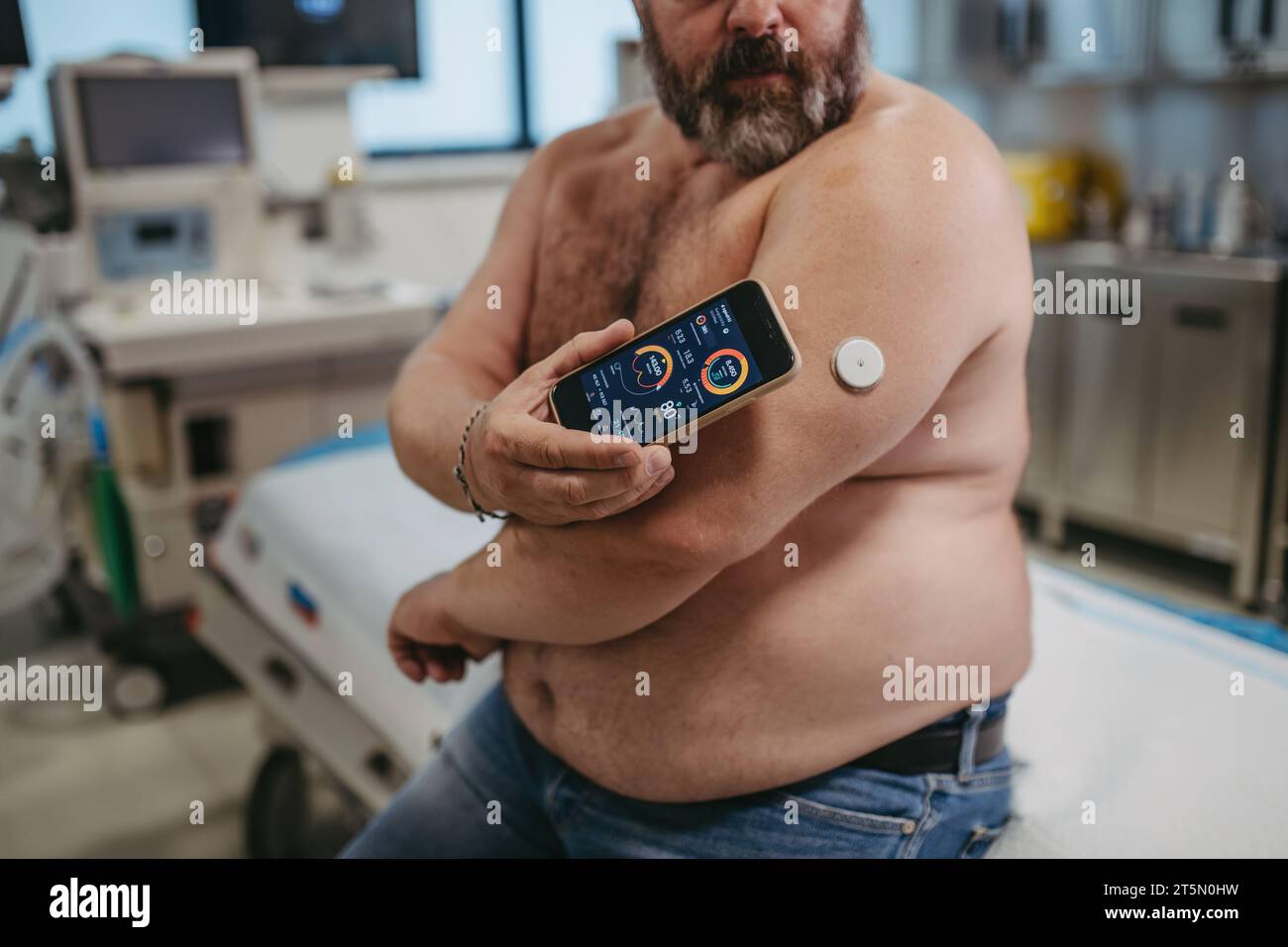 Paziente collegato al monitor glucosio continuo con lo smartphone, per controllare il livello di zucchero nel sangue in tempo reale. L'uomo obeso e sovrappeso è a rischio di sviluppo Foto Stock