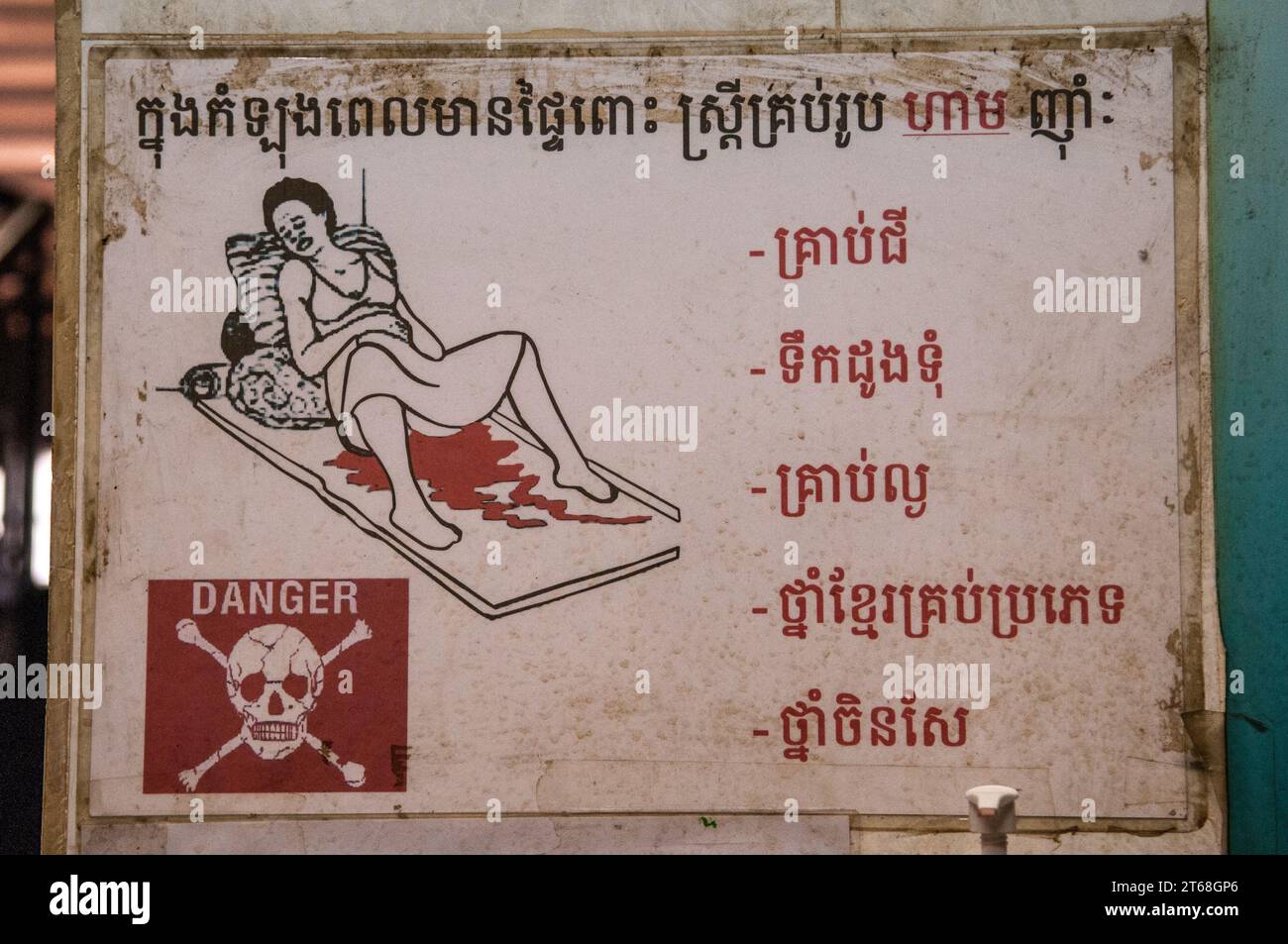 I pericoli del parto. Segnale di avvertimento bilingue sul parto in un ospedale di maternità, Phnom Penh, Cambogia. Crediti: Kraig Lieb Foto Stock
