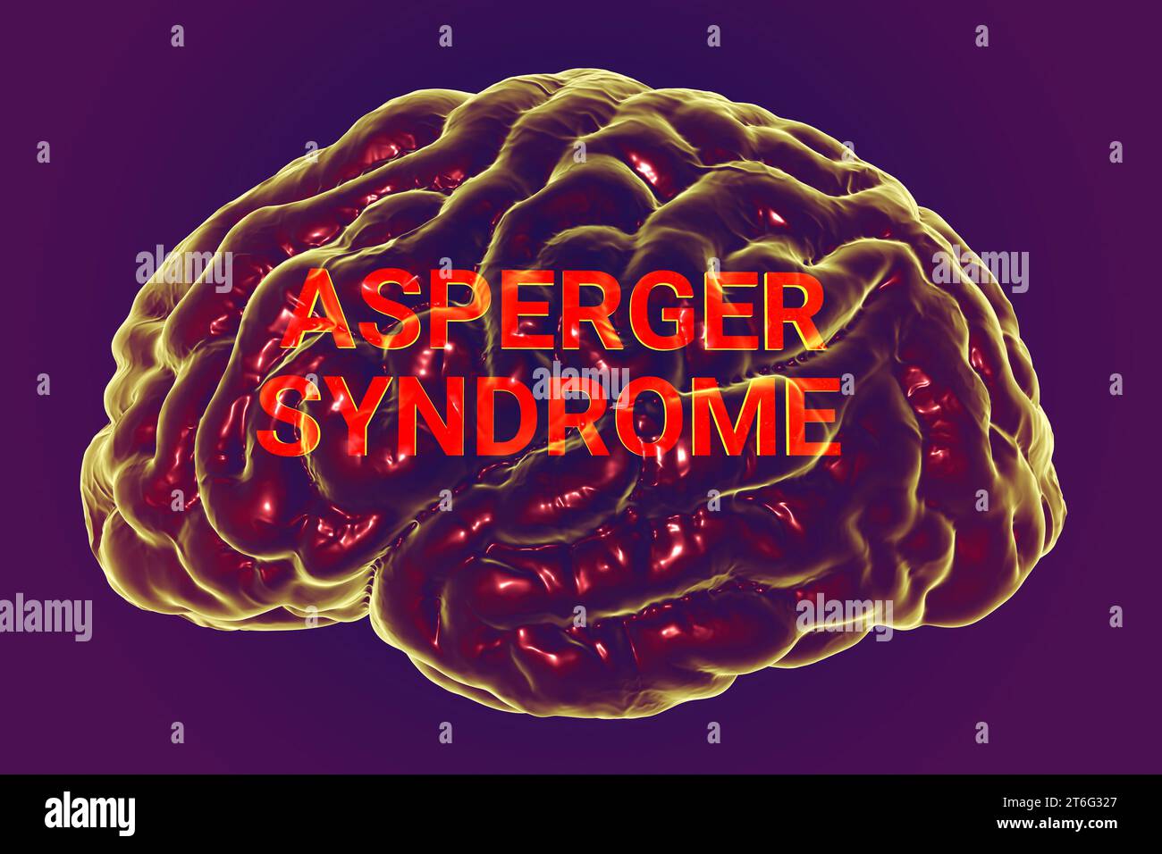 Un'illustrazione 3D concettuale con il testo sindrome di Asperger all'interno del modello anatomico di un cervello umano, evidenziando le basi neurologiche di Foto Stock
