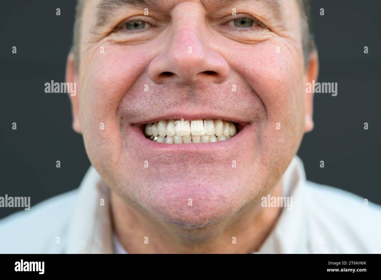 Primo piano estremo del sorriso di un uomo con grandi denti davanti a uno sfondo nero Foto Stock