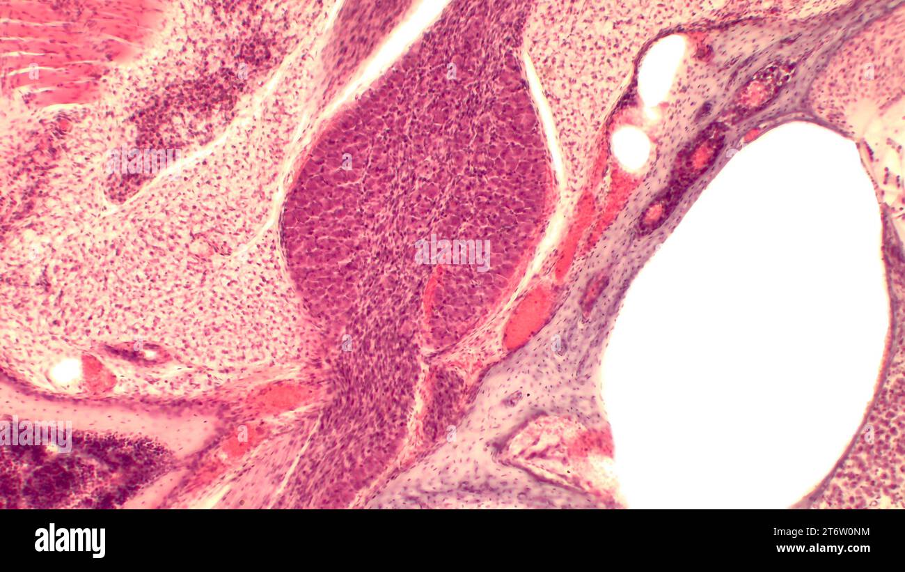 Sezione attraverso il nucleo cocleare umano sotto microscopio. Vetrino istologico colorato con ematossilina ed eosina (H&e). Foto Stock