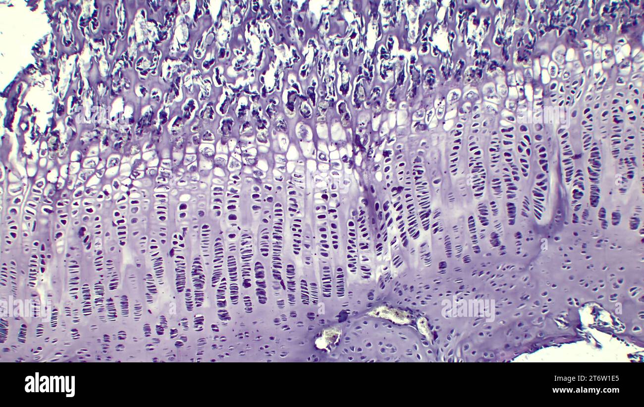 Sviluppo dell'osso al posto del modello cartilagine. La piastra di crescita è formata da cartilagine costituita da cellule della cartilagine in proliferazione. Foto Stock