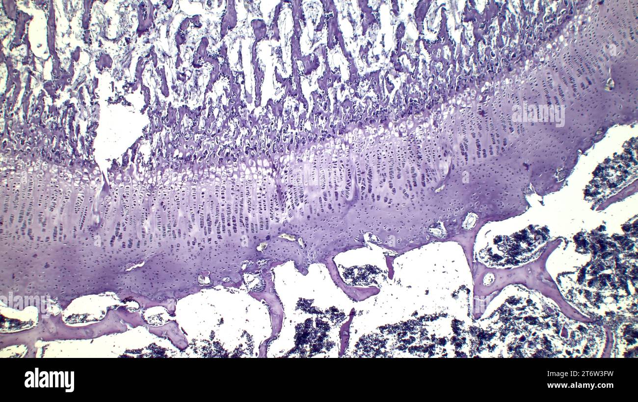 Sviluppo dell'osso al posto del modello cartilagine. La piastra di crescita è formata da cartilagine costituita da cellule della cartilagine in proliferazione. Foto Stock