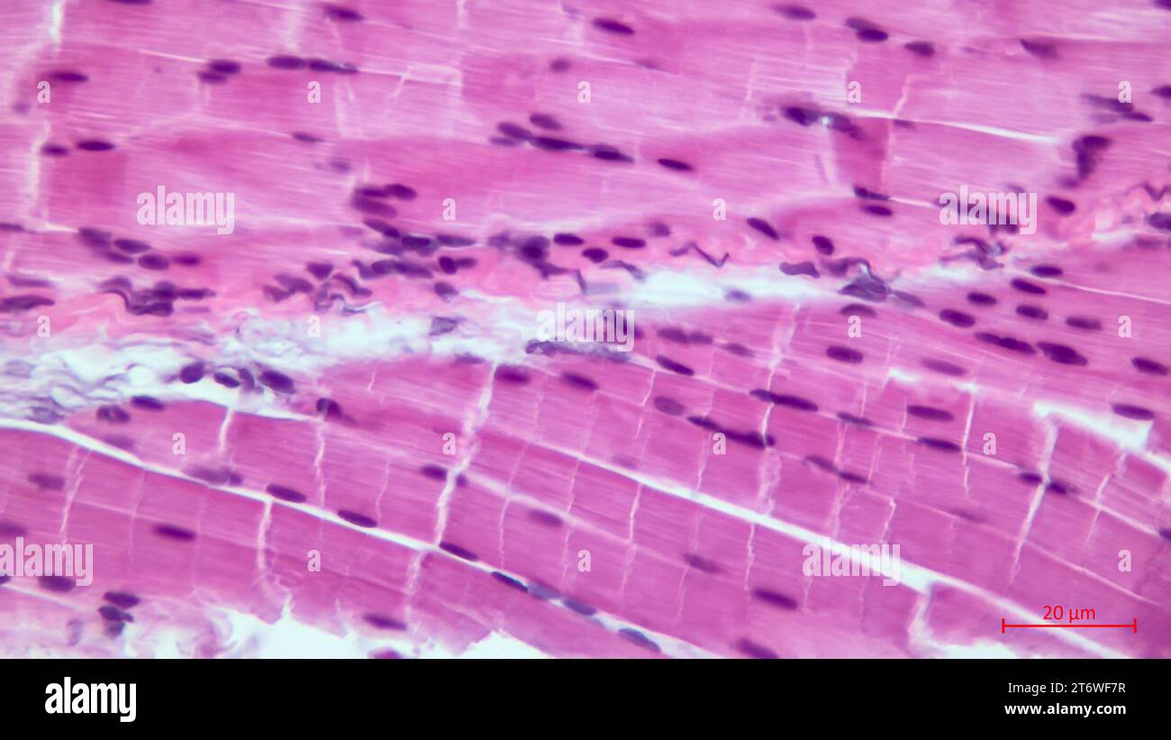 Micrografia leggera di una sezione attraverso il muscolo scheletrico. Fascicoli di fibre muscolari. Colorazione eosina con ematossilina finale. Ingrandimento: X200 Foto Stock