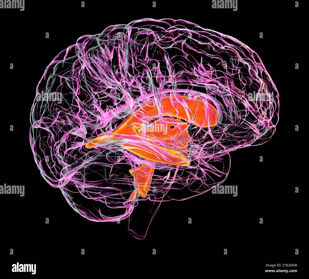 Sistema ventricolare del cervello di un bambino, illustrazione Foto Stock