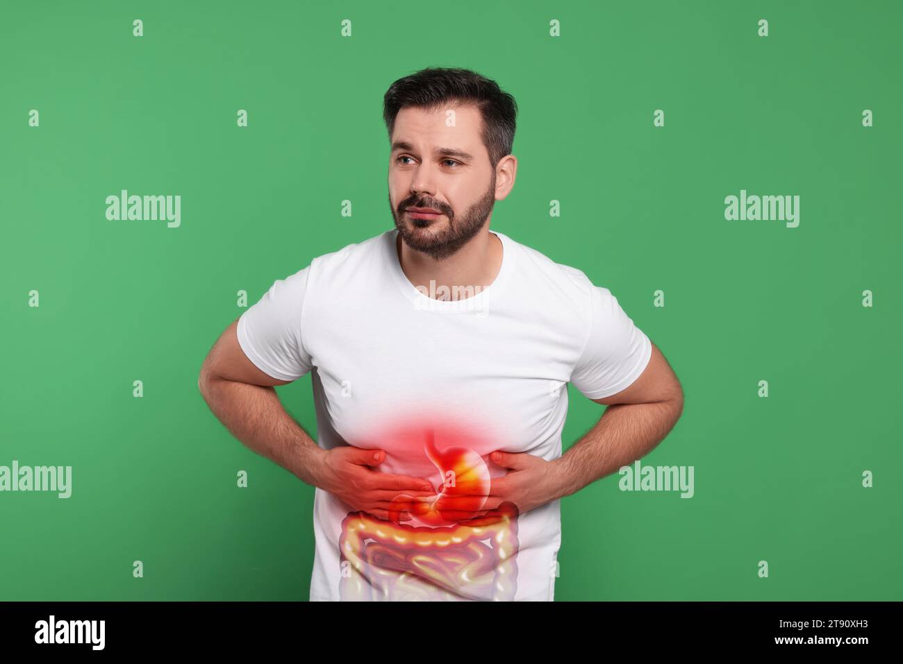 Uomo che soffre di mal di stomaco su sfondo verde. Illustrazione del tratto gastrointestinale malsano Foto Stock