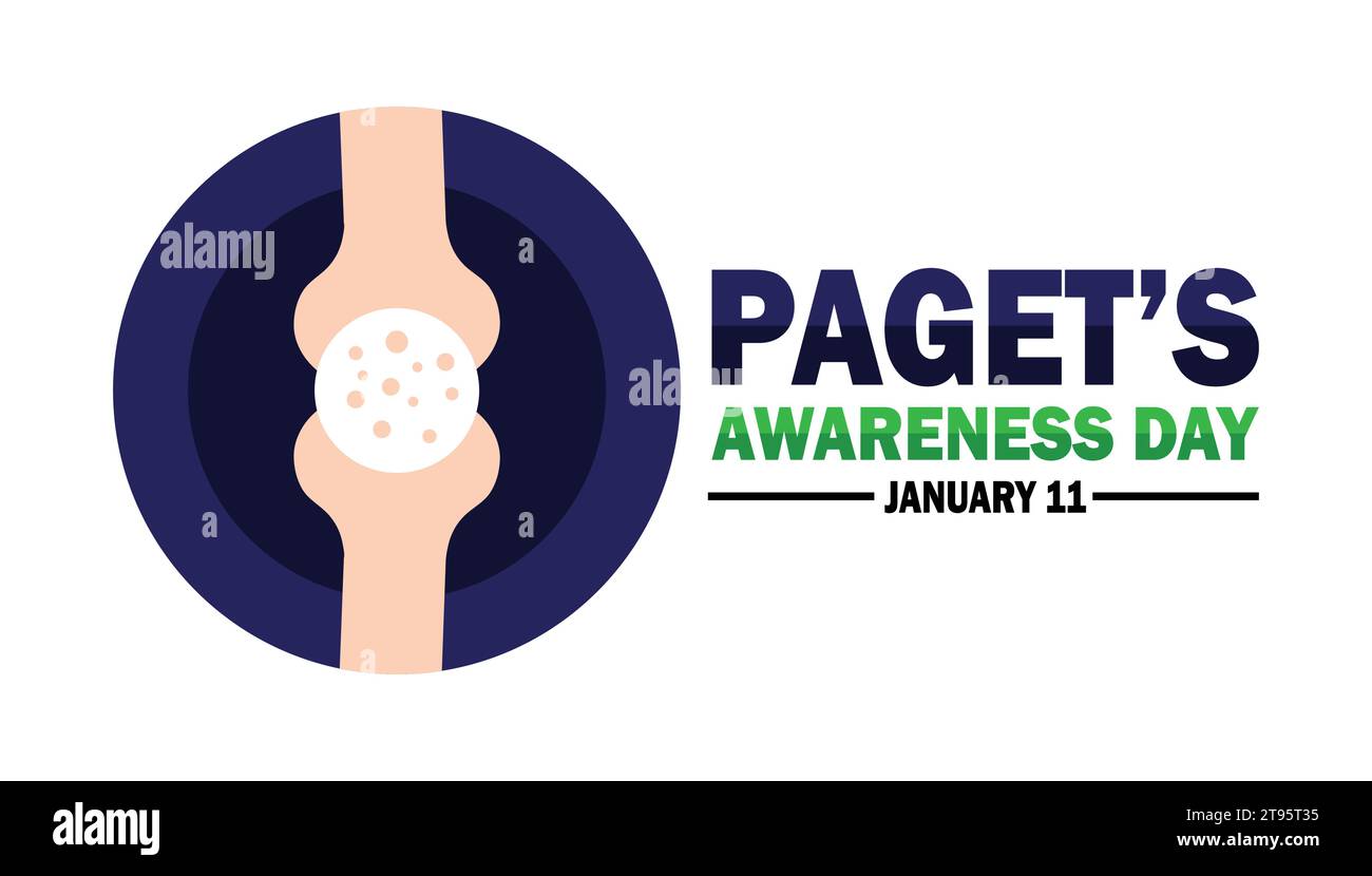 Giornata di sensibilizzazione di Paget. Illustrazione vettoriale. 11 gennaio. Adatto per biglietti d'auguri, poster e striscioni. Illustrazione Vettoriale