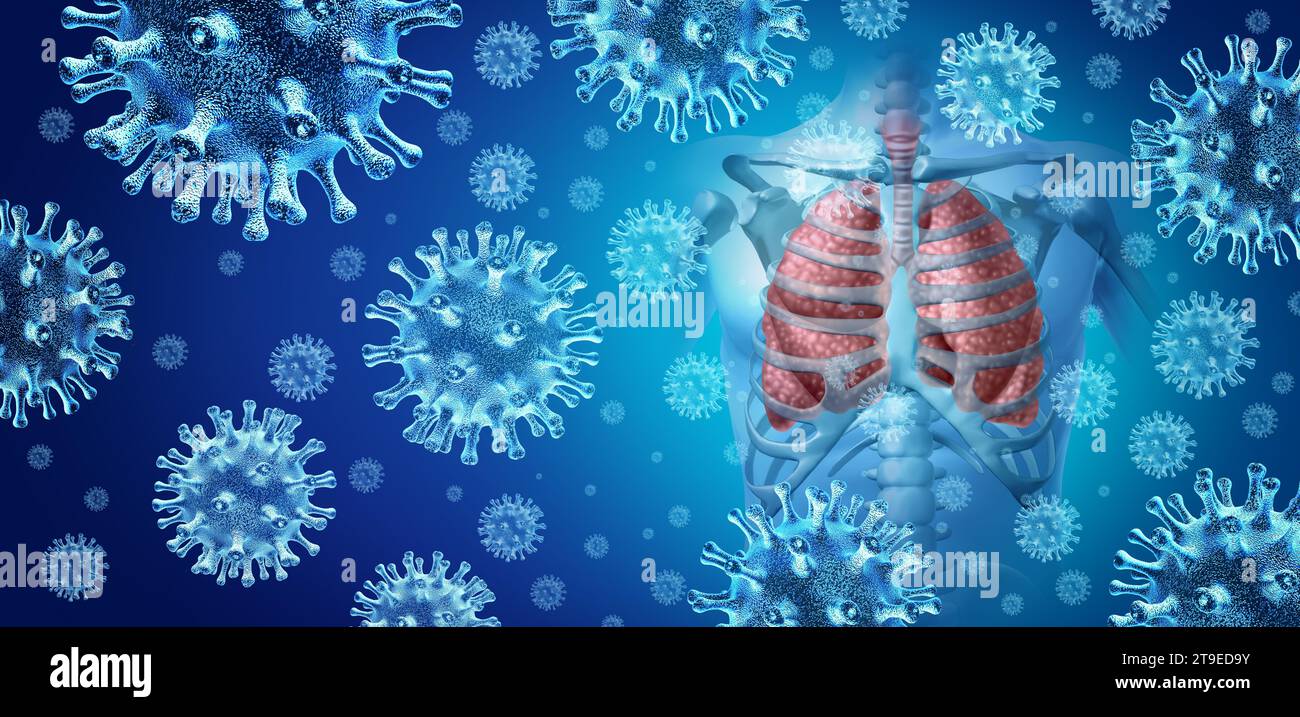 Polmonite respiratoria focolaio come virus patogeno che si diffonde come un'infezione polmonare e infezioni polmonari umane o malattie infiammatorie respiratorie Foto Stock