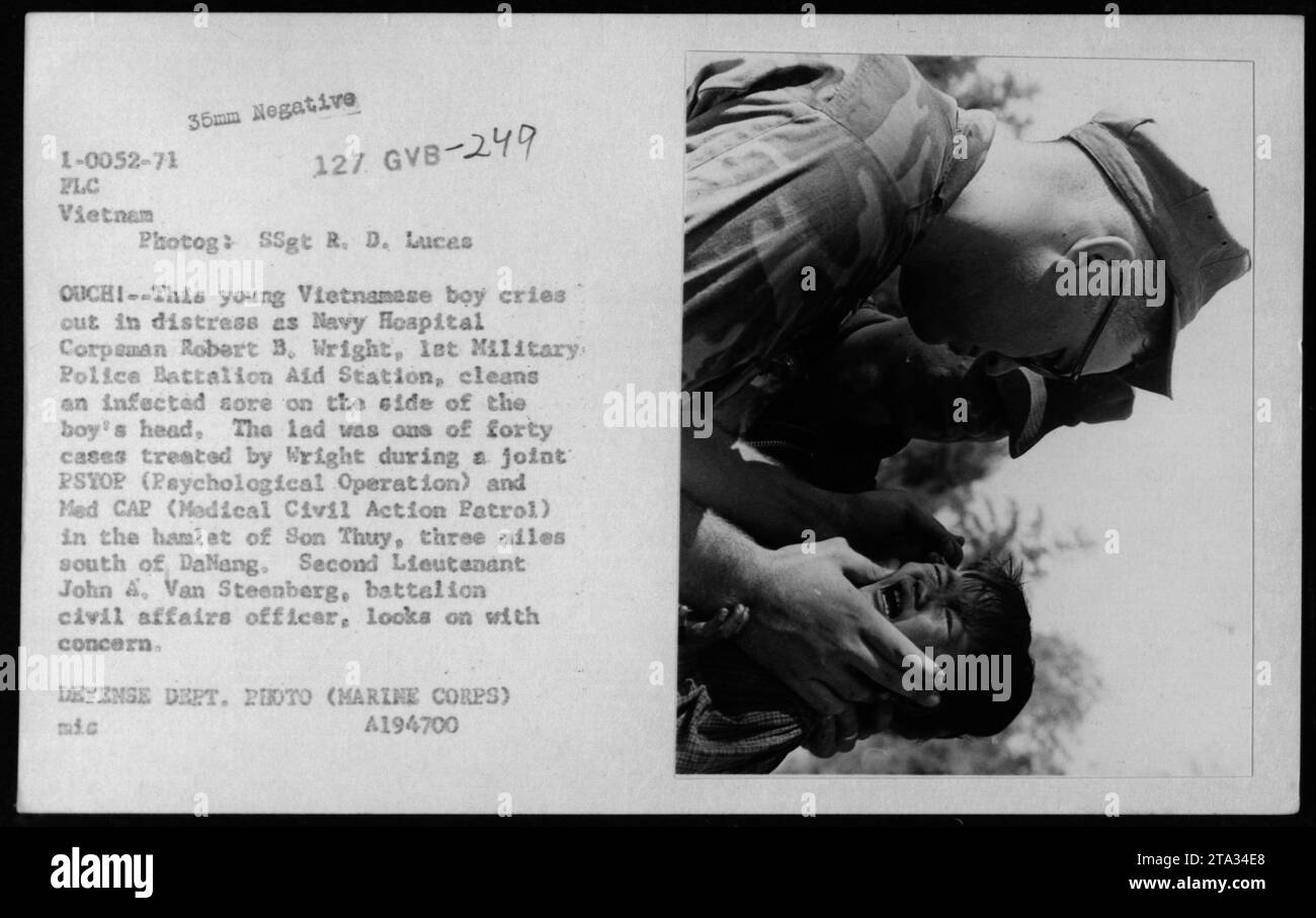 Un giovane ragazzo vietnamita grida mentre il corpo del Navy Hospital Robert B. Wright pulisce un dolore infetto sul lato della sua testa. Il ragazzo era uno dei quaranta casi trattati durante un PSYOP congiunto e un Med CAP a Son Thuy, tre miglia a sud di Danang. Il sottotenente John A. Van Steenberg osserva. (Fonte: Foto del Dipartimento della difesa) Foto Stock