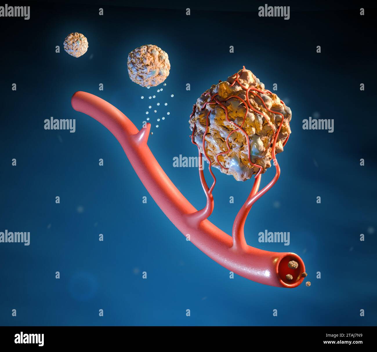 Cellule tumorali che usano l'angiogenesi per crescere e diffondersi attraverso il corpo. Illustrazione digitale, rendering 3D. Foto Stock